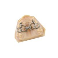 Expander Anatomical 12 mm CAD-CAM 1 ks