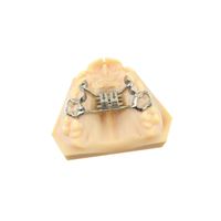 Expander Rapid CAD-CAM