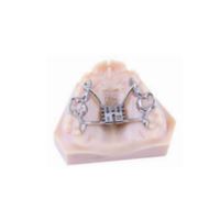 Patrový expanzní šroub CAD-CAM Tooth Borne 8 mm