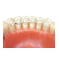 Retainer plochý drát 1,5m 1 ks