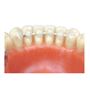 Retainer plochý drát 1,5m 1 ks
