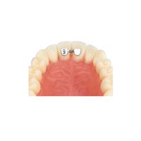 Retainer horní 1-1 10 ks