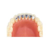 Retainer kit cuspid dolní 3-3 (20ks různé)