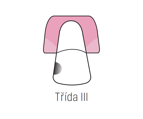 Indikace Systému Stela - Třída III