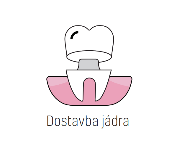 Indikace Systému Stela - Dostavba jádra