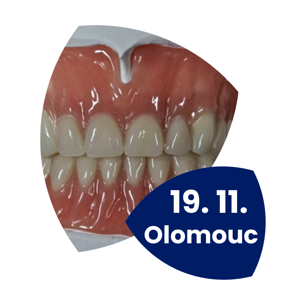 Hybridní a skeletové náhrady s teleskopickými korunkami - Olomouc