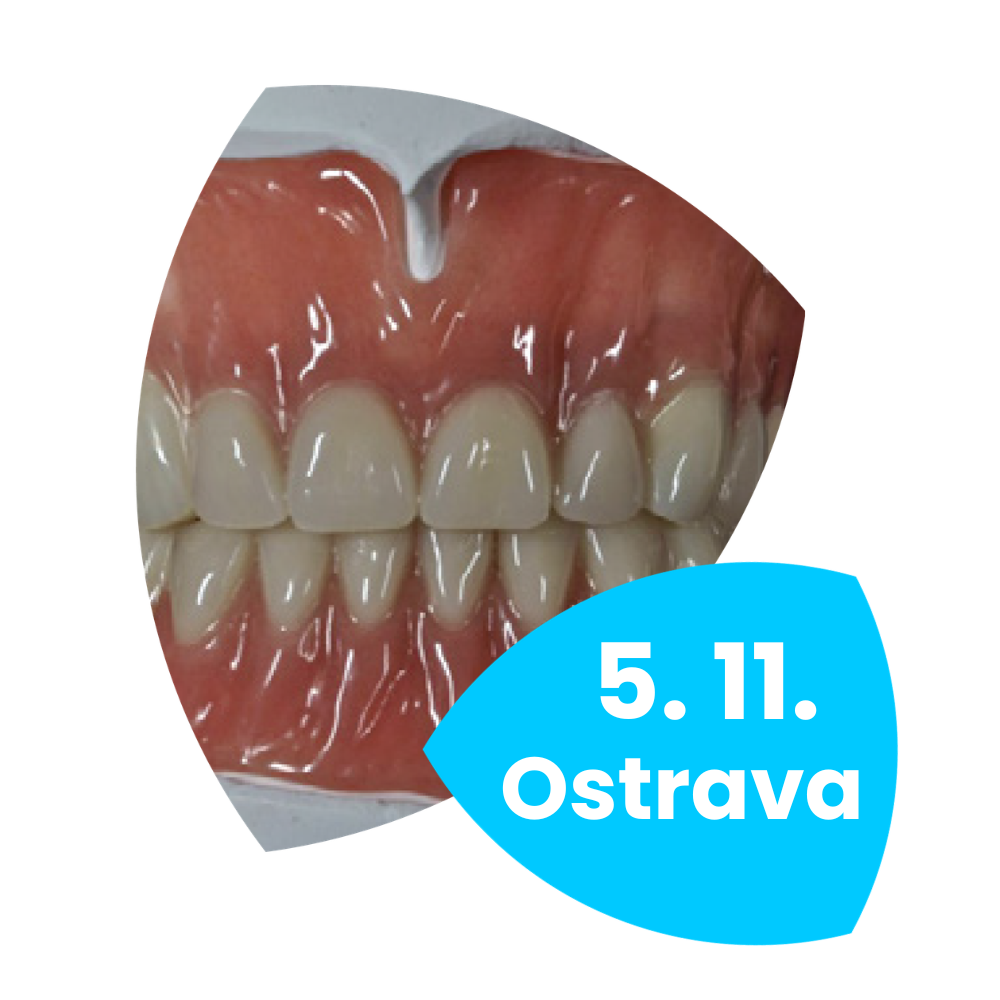 Hybridní a skeletové náhrady s teleskopickými korunkami - Ostrava